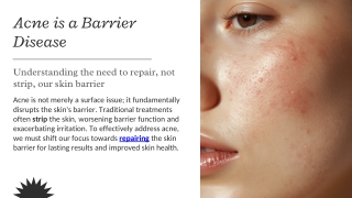 Presentation - Acne as a Barrier Disease