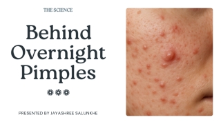 Presentation - Behind Overnight Pimples