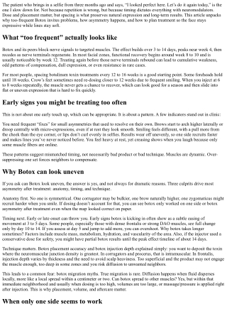 Too Frequent Botox: Risks to Outcomes and Natural Expression