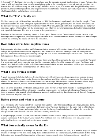 Botox for Frown Lines (11s): Before and After Insights