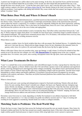 Botox vs Laser Treatment: Best Uses and Combined Plans