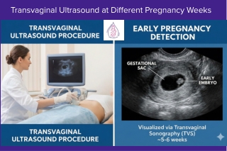 Find the Best Abortion Clinic Near You – Safe, and Confidential Services