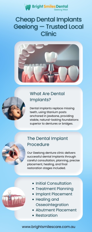 Cheap Dental Implants Geelong — Trusted Local Clinic
