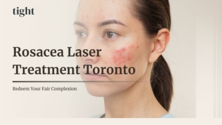 Personalized Rosacea Laser Treatment Toronto