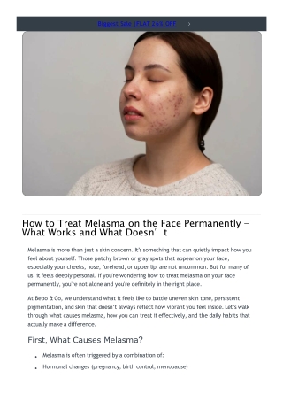 Best Treatment for Melasma on Face Long Term Results