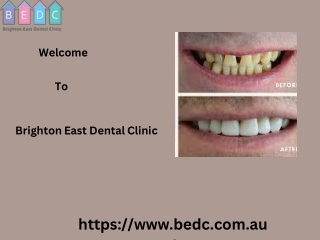 Trusted Dentist in Ormond & Bentleigh VIC for Complete Dental Care