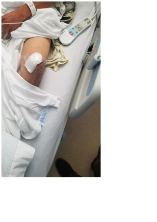 Recognizing Your Civil Liberties After An Automobile Accident American Judicial