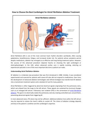 How to Choose the Best Cardiologist for Atrial Fibrillation Ablation Treatment