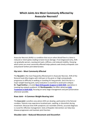 Which Joints Are Most Commonly Affected by Avascular Necrosis?