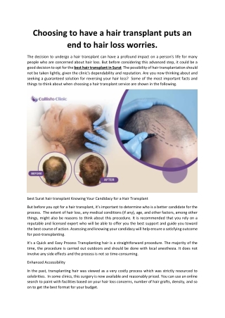 Choosing to have a hair transplant puts an end to hair loss worries.