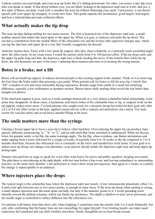 Nose Tip Droops When You Smile? Botox Dos and Don’ts