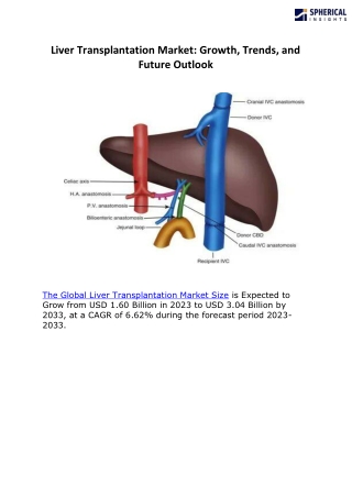 Liver Transplantation Market F