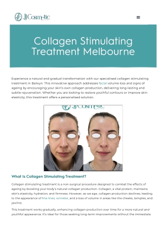 Collagen Stimulating Treatment Balwyn | Melbourne's Premier PRF Clinic
