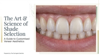 The Art and Science of Dental Veneer Shade Selection