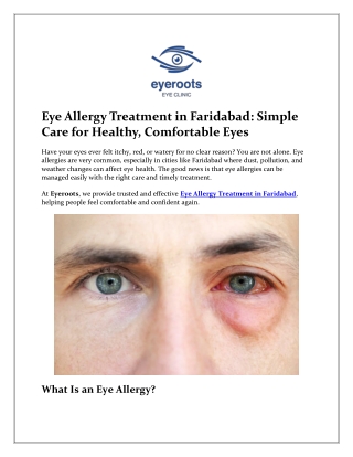 Best Eye Allergy Treatment in Faridabad | Effective Relief at Eye-Roots