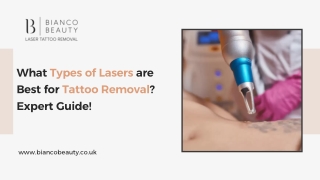 What Types of Lasers are Best for Tattoo Removal? Expert Guide!