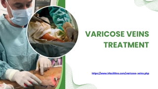 Varicose Veins Treatment in India | Advanced & Affordable Care