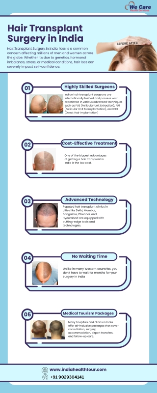 Hair Transplant Surgery in India (1)