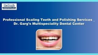 Professional Scaling Teeth and Polishing Services : Dr. Garg’s Dental Center