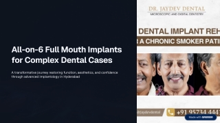 All-on-6-Full-Mouth-Implants-for-Complex-Dental-Cases