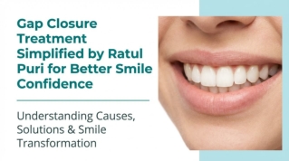 Gap Closure Treatment Simplified by Ratul Puri for Better Smile Confidence