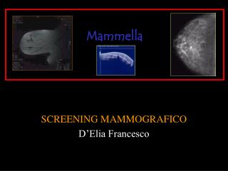 SCREENING MAMMOGRAFICO D’Elia Francesco