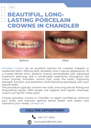 Beautiful, Long-Lasting Porcelain Crowns in Chandler
