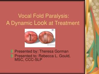 Vocal Fold Paralysis: A Dynamic Look at Treatment