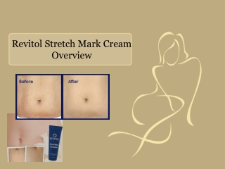 Revitol Stretch Mark Cream Overview