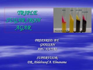 TRIPLE SUGAR IRON AGAR