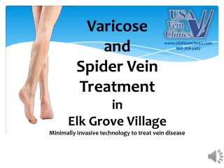 USA Vein Clinics- Vein Treatment in Elk Grove Village, IL