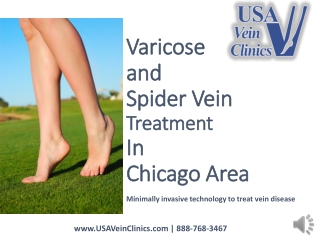USA Vein Clinics- Vein Treatment in Chicago, IL