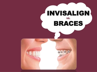 Expert Cosmetic Dentist in Elk Grove for braces & Invisalign