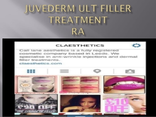 Juvederm Ultra Filler Treatment