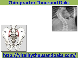 Chiropractor Thousand Oaks