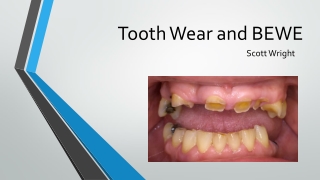 Tooth Wear and BEWE