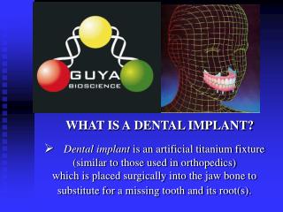 WHAT IS A DENTAL IMPLANT?