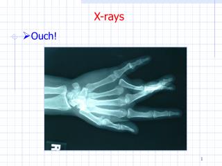 PPT - X-rays PowerPoint Presentation, free download - ID:1712094