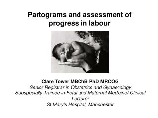 Partograms and assessment of progress in labour