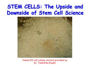 STEM CELLS: The Upside and Downside of Stem Cell Science