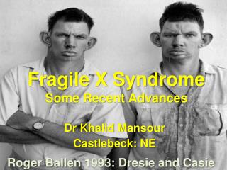 Fragile X Syndrome Some Recent Advances
