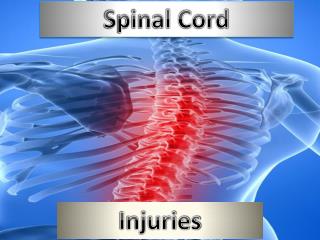 PPT - Spinal Cord PowerPoint Presentation, free download - ID:1926528