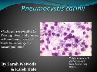 PPT - Pneumocystis carinii PowerPoint Presentation, free download - ID ...