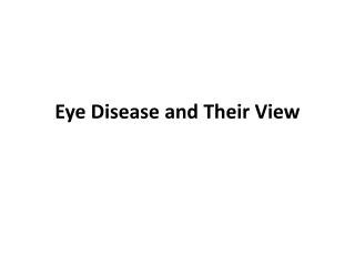 Eye Disease and Their View