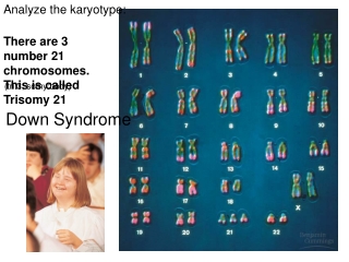 There are 3 number 21 chromosomes. This is called Trisomy 21