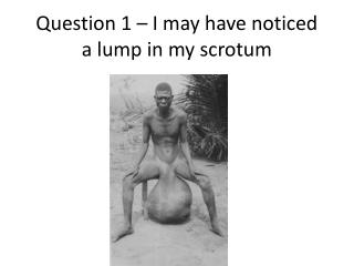 Question 1 – I may have noticed a lump in my scrotum