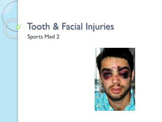 Tooth & Facial Injuries