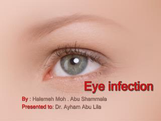 PPT - Eye infection PowerPoint Presentation, free download - ID:2049121