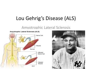 PPT - Lou Gehrig’s Disease (ALS) PowerPoint Presentation, free download