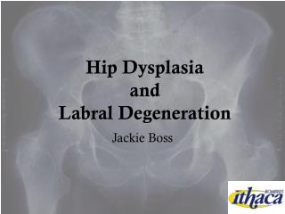 Hip Dysplasia and Labral Degeneration